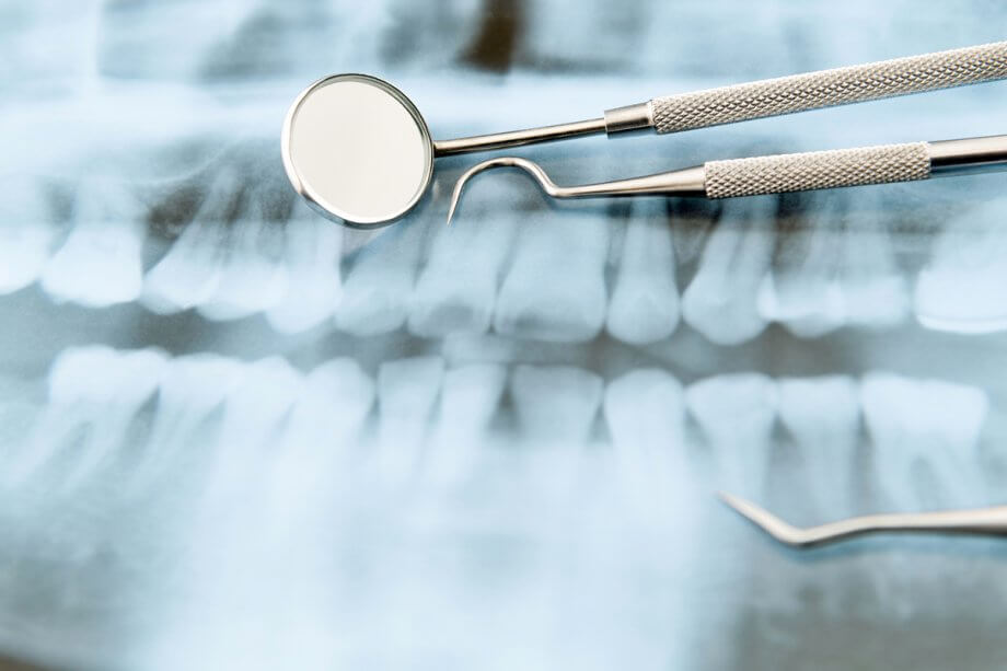 What Causes Root Resorption In Teeth?